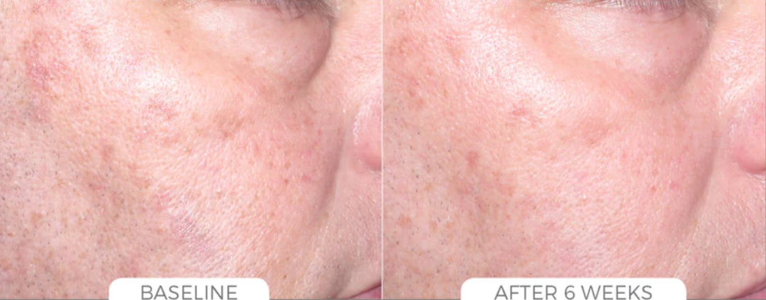 Skin Brightening System
