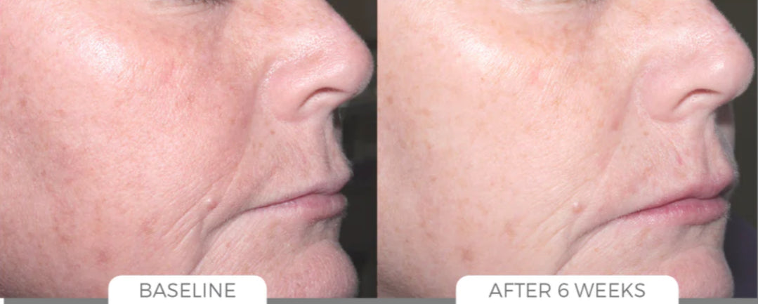 Skin Brightening System