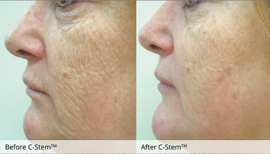 C-Stem Elixir