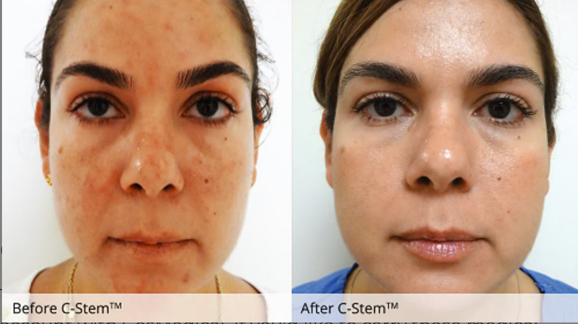 C-Stem Elixir